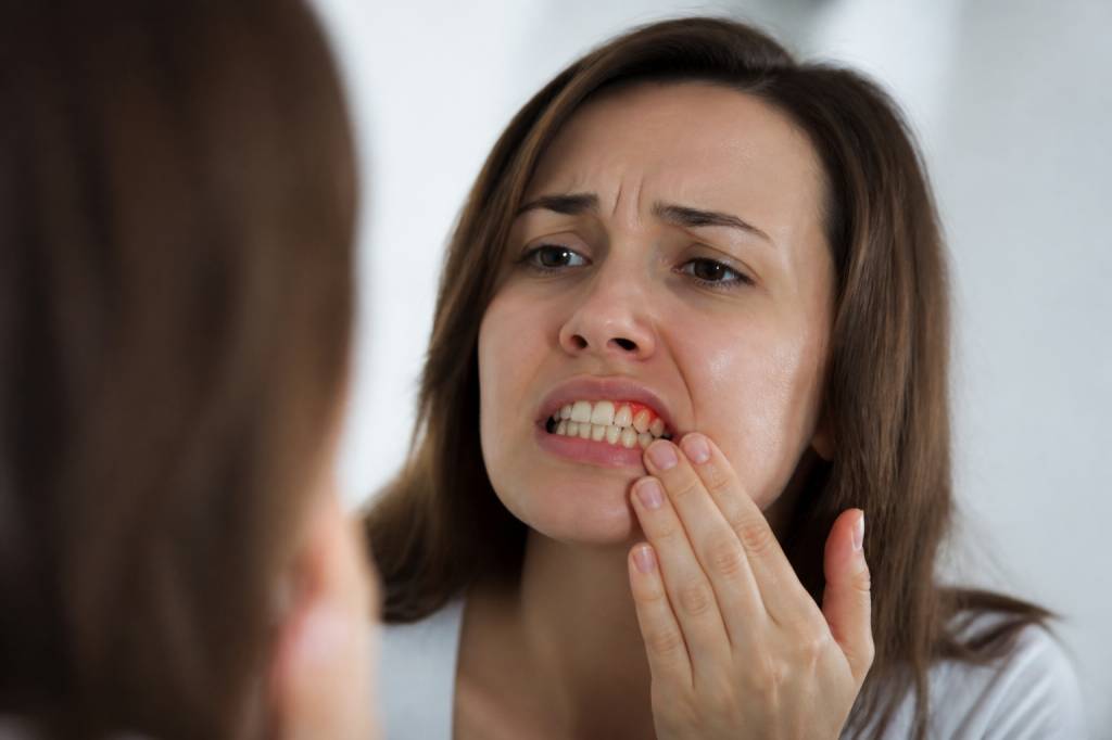Abcès gingival traitement naturel pour soulager la douleur et favoriser la guérison